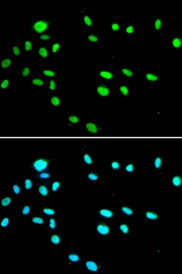 Anti-RUVBL1 Antibody