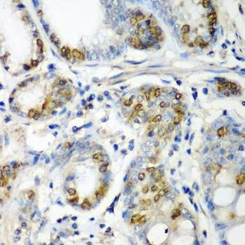Anti-CRYAA Antibody