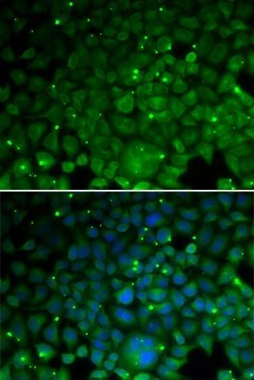 Anti-CRYAA Antibody