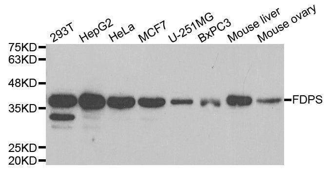 Anti-FDPS Antibody