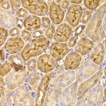 Anti-FDPS Antibody