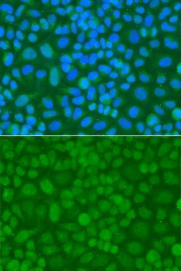 Anti-TDG Antibody