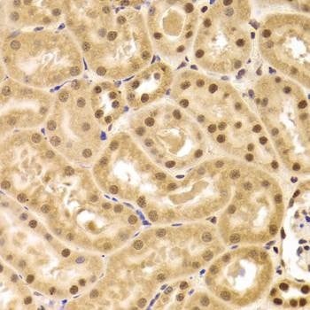Anti-ANP32A Antibody