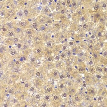 Anti-ANP32A Antibody