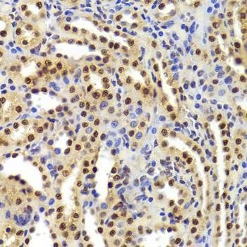 Anti-ANP32A Antibody