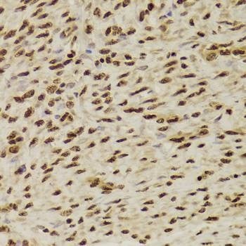 Anti-ANP32A Antibody