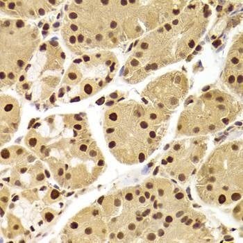 Anti-ANP32A Antibody