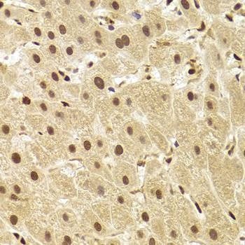 Anti-ANP32A Antibody