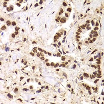 Anti-ANP32A Antibody