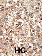 Anti-PIASy (N-term) Antibody