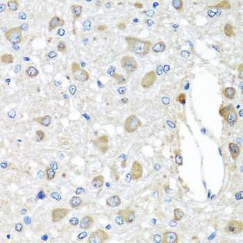 Anti-BAG5 Antibody