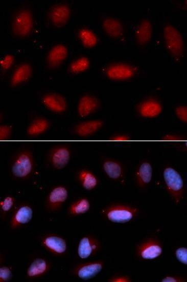 Anti-SERPINA6 Antibody