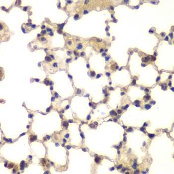 Anti-CXXC1 Antibody