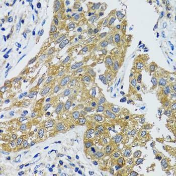 Anti-GOT1 Antibody
