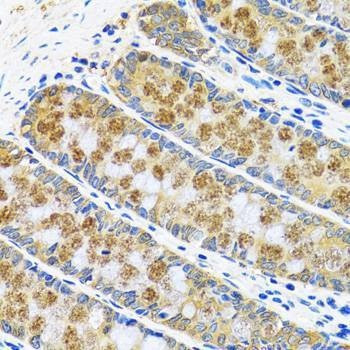 Anti-GOT1 Antibody