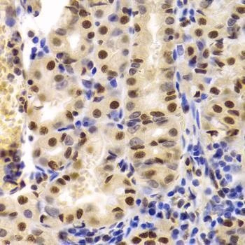 Anti-XRCC5 Antibody