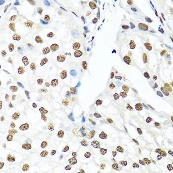 Anti-XRCC5 Antibody