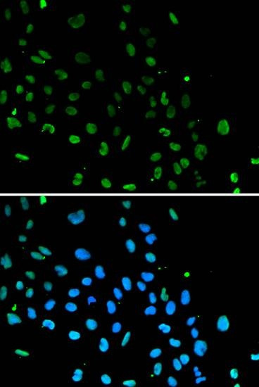 Anti-XRCC5 Antibody