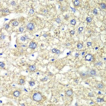 Anti-ATP5A1 Antibody