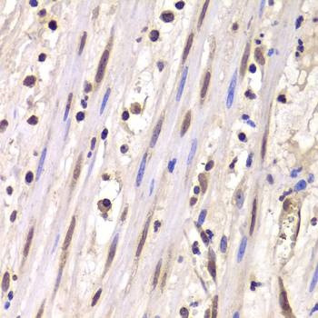 Anti-LSM4 Antibody