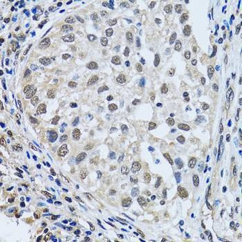 Anti-LSM4 Antibody