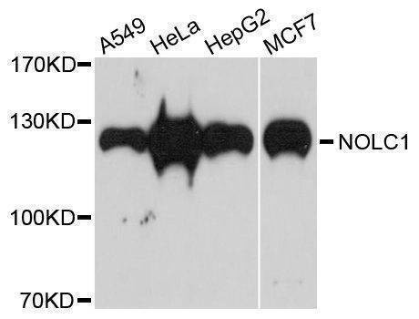 Anti-NOLC1 Antibody