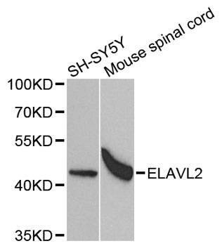 Anti-ELAVL2 Antibody