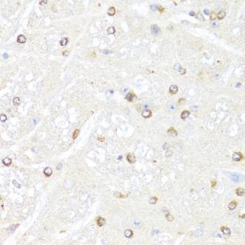 Anti-POLR2B Antibody
