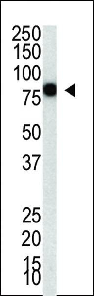 Anti-PIASy1 (C-term) Antibody
