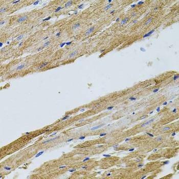 Anti-TRMT2A Antibody