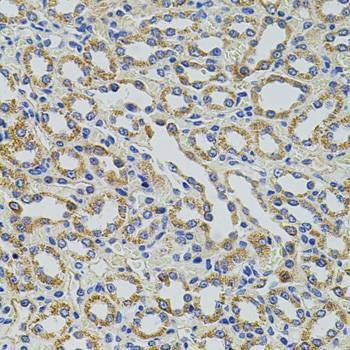 Anti-TRMT2A Antibody