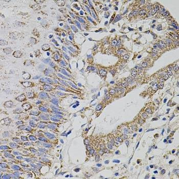Anti-TRMT2A Antibody