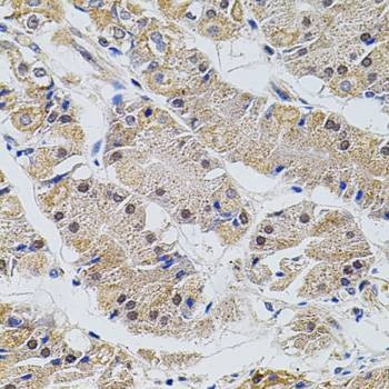 Anti-TRMT2A Antibody