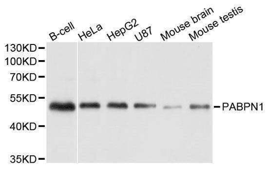 Anti-PABPN1 Antibody