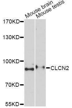 Anti-CLCN2 Antibody