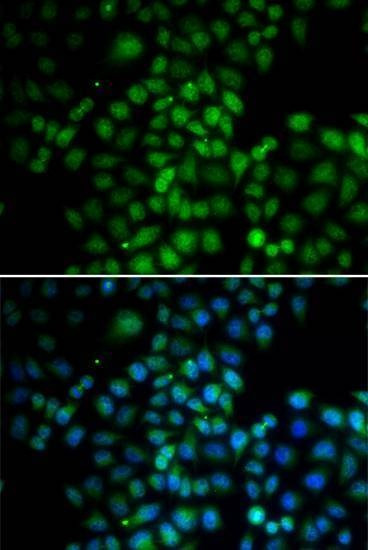 Anti-C11orf30 Antibody