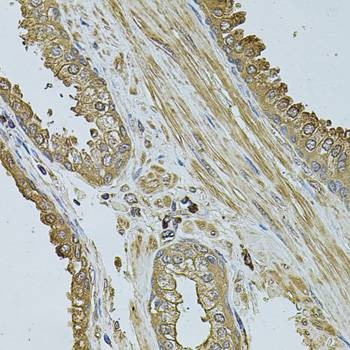 Anti-MYLIP Antibody