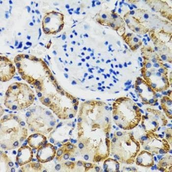 Anti-COMT Antibody