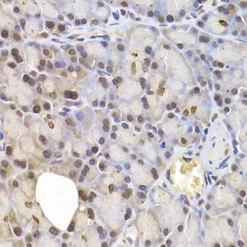 Anti-IRF6 Antibody