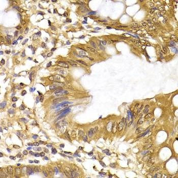 Anti-IRF6 Antibody