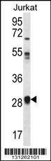 Anti-OR11L1 (C-term) Antibody