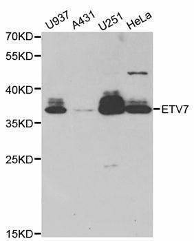 Anti-ETV7 Antibody