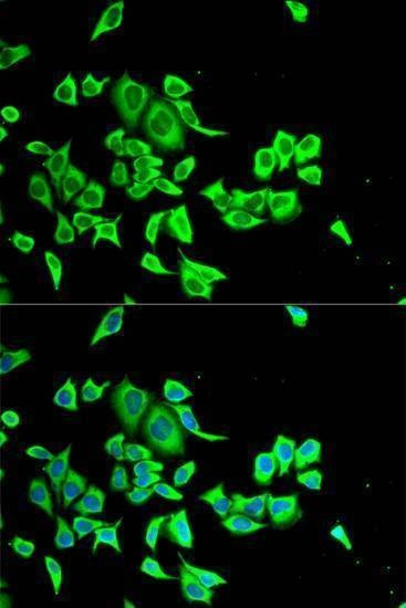 Anti-SERPINB1 Antibody