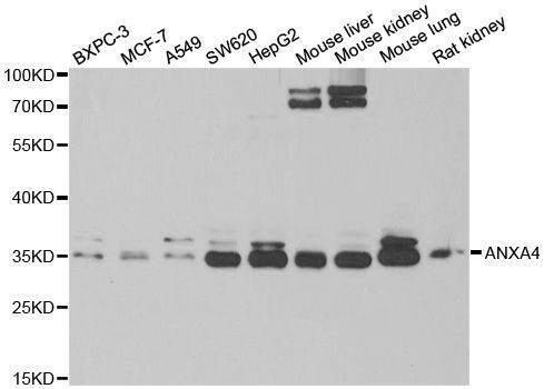 Anti-ANXA4 Antibody