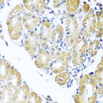 Anti-BNIP3L Antibody