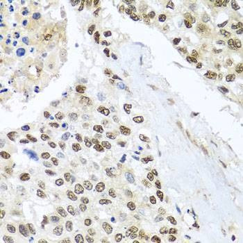 Anti-BNIP3L Antibody