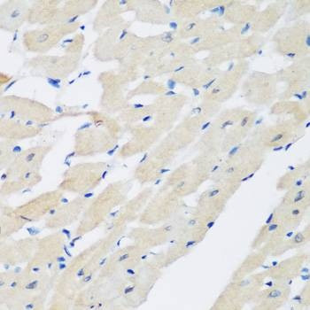 Anti-PLEK Antibody
