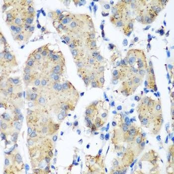 Anti-PLEK Antibody