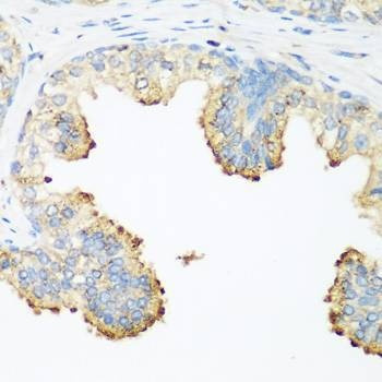 Anti-PLEK Antibody