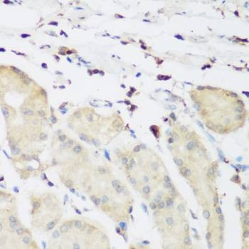 Anti-PLEK Antibody